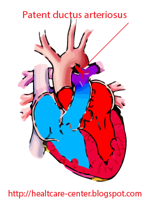 szív egészségügyi grafika menü egy hétig 3 fokos magas vérnyomás esetén
